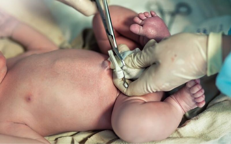 Công nghệ tế bào gốc trong thẩm mỹ sử dụng tế bào gốc từ màng cuống rốn
