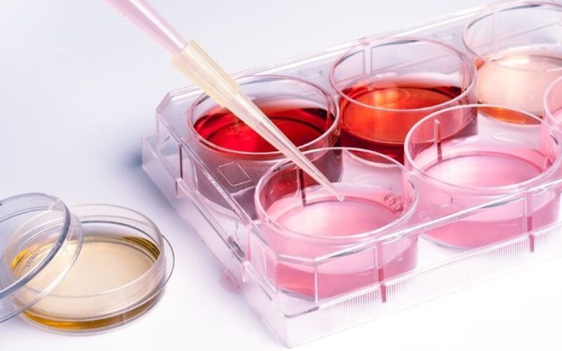 Cấy ghép tế bào gốc tự thân