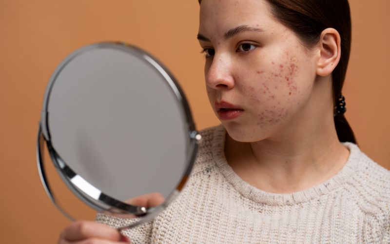 Khi máu trong cơ thể nhiễm độc tố, làn da thường là nơi biểu hiện rõ rệt nhất các dấu hiệu cảnh báo