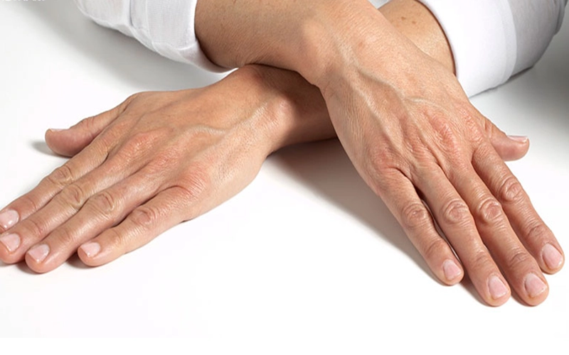 Một số người có thể cân nhắc đến phương pháp trẻ hóa da tay
