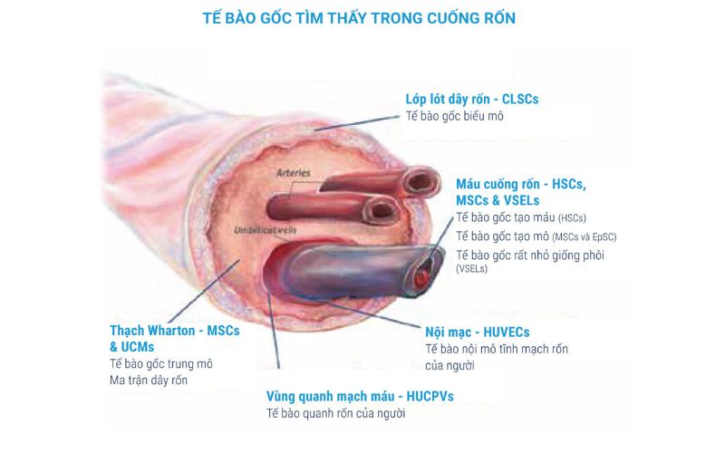 Tế bào gốc trung mô từ dây rốn&nbsp;được lấy từ trong dây rốn của thai nhi
